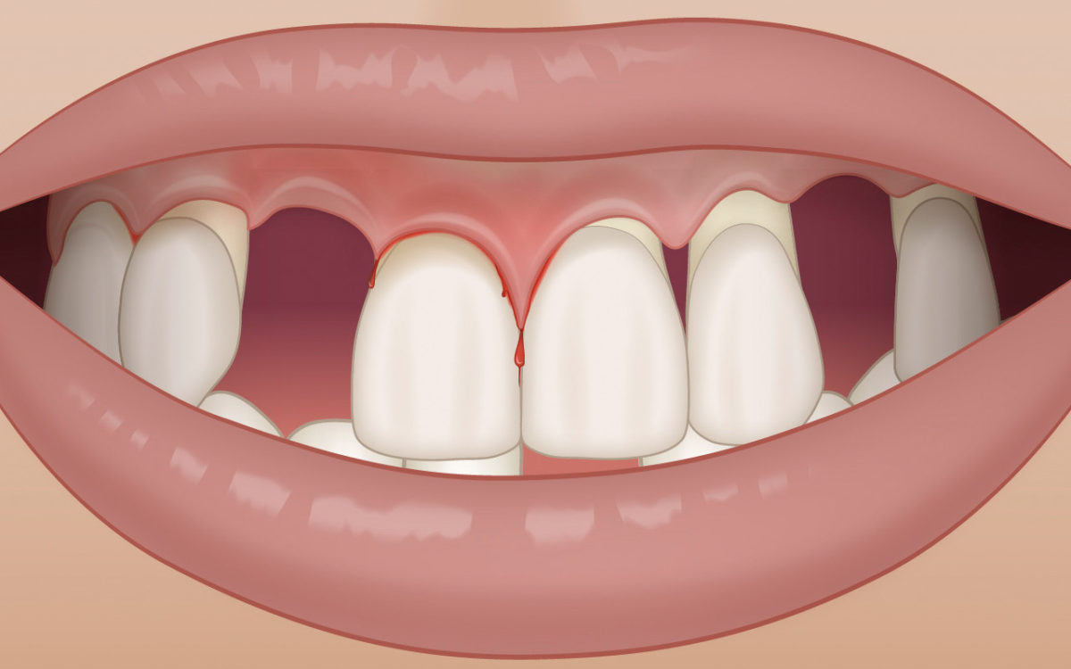 Probleme mit dem Aussehen (Ästhetik)