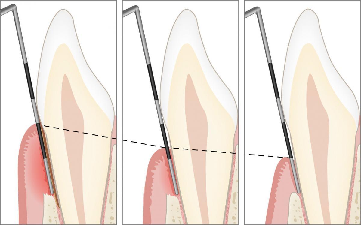 Nachkontrolle (Reevaluation)